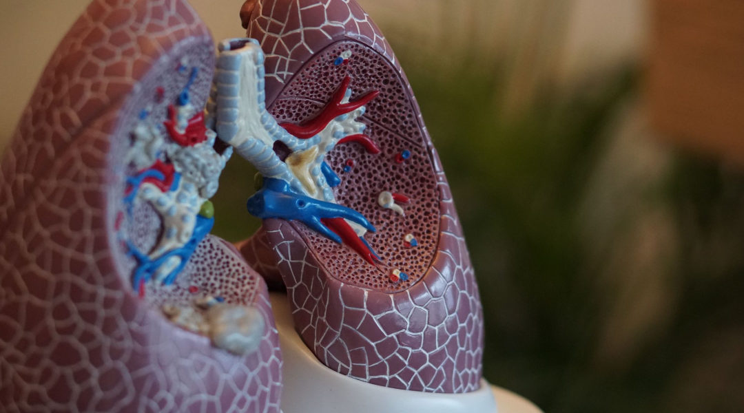 How Alpha-Klotho Can Help Prevent IPF –  A Chronic And Progressive Lung Disease